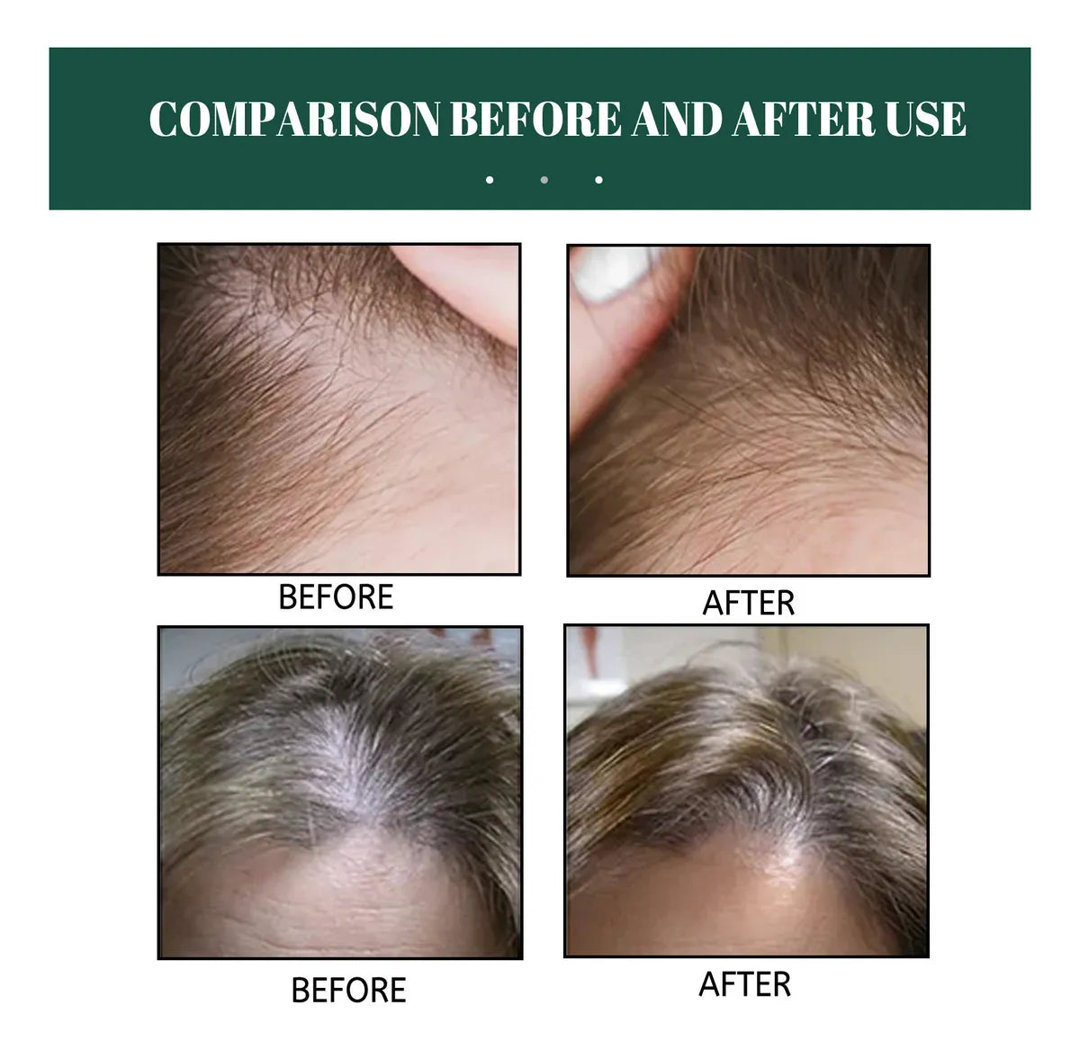 OUHOE™ Serum Capilar - 30ml